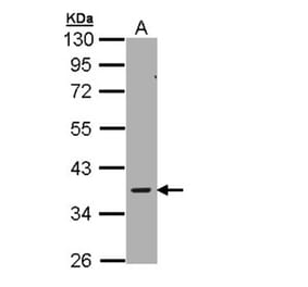 AMPK gamma-2 antibody from Signalway Antibody (22007) - Antibodies.com