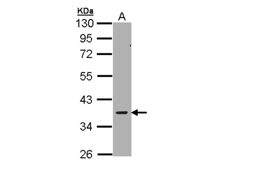 AMPK gamma-2 antibody from Signalway Antibody (22007) - Antibodies.com