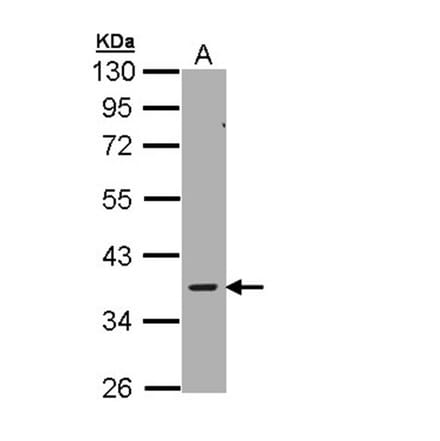 AMPK gamma-2 antibody from Signalway Antibody (22007) - Antibodies.com