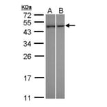 NNT-1/BSF-3 antibody from Signalway Antibody (22627) - Antibodies.com