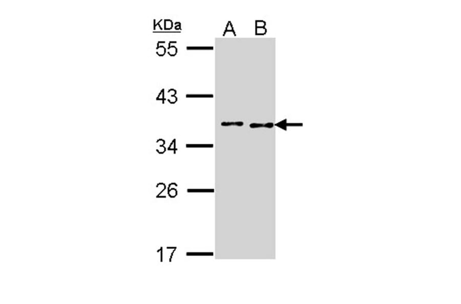 TOK-1 alpha antibody from Signalway Antibody (22674) - Antibodies.com