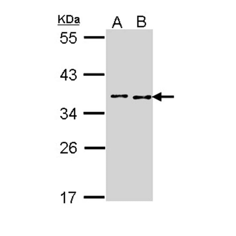TOK-1 alpha antibody from Signalway Antibody (22674) - Antibodies.com