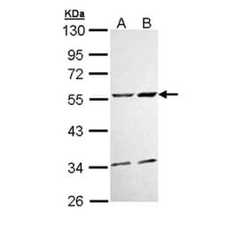 CaMKII delta antibody from Signalway Antibody (22853) - Antibodies.com