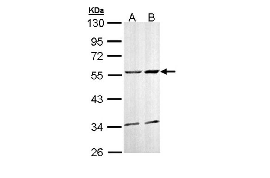 CaMKII delta antibody from Signalway Antibody (22853) - Antibodies.com