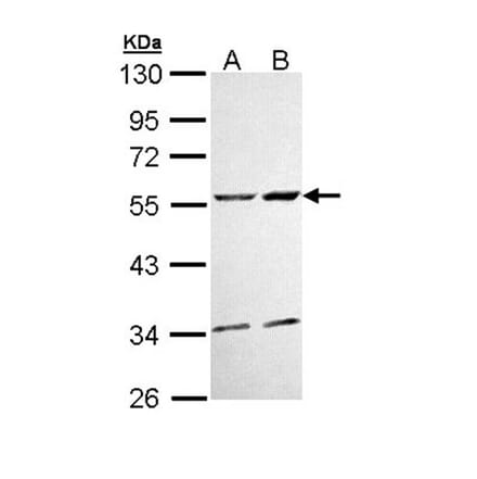 CaMKII delta antibody from Signalway Antibody (22853) - Antibodies.com