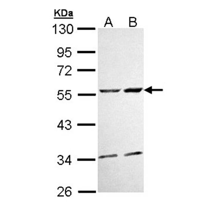 CaMKII delta antibody from Signalway Antibody (22853) - Antibodies.com