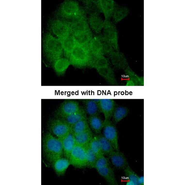Immunofluorescence - CaMKII delta antibody from Signalway Antibody (22853) - Antibodies.com