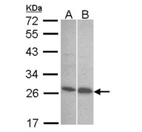 Endothelin 1 antibody from Signalway Antibody (22887) - Antibodies.com