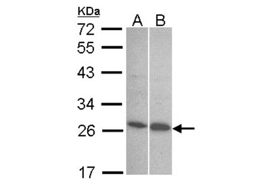 Endothelin 1 antibody from Signalway Antibody (22887) - Antibodies.com