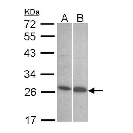 Endothelin 1 antibody from Signalway Antibody (22887) - Antibodies.com
