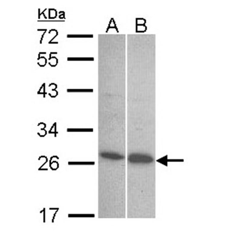 Endothelin 1 antibody from Signalway Antibody (22887) - Antibodies.com