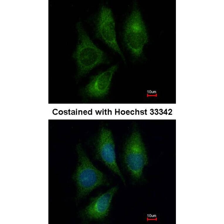 Immunofluorescence - Endothelin 1 antibody from Signalway Antibody (22887) - Antibodies.com
