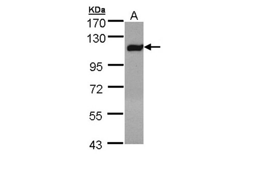 Factor XIIIa antibody from Signalway Antibody (22994) - Antibodies.com