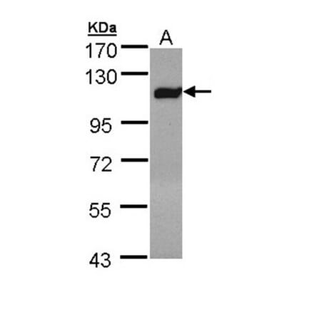 Factor XIIIa antibody from Signalway Antibody (22994) - Antibodies.com