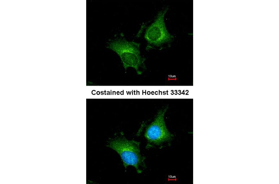 Immunofluorescence - Factor XIIIa antibody from Signalway Antibody (22994) - Antibodies.com