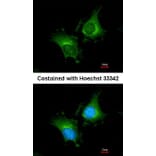 Immunofluorescence - Factor XIIIa antibody from Signalway Antibody (22994) - Antibodies.com