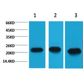 Western blot - Peroxiredoxin 1 Mouse Monoclonal Antibody from Signalway Antibody (38055) - Antibodies.com