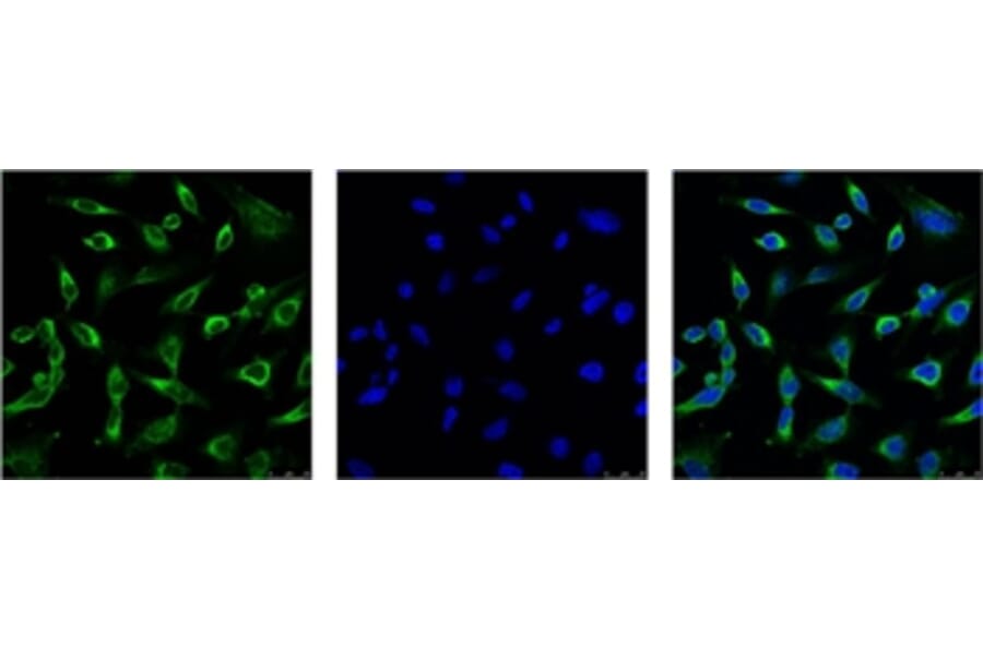 Peroxiredoxin 1 Mouse Monoclonal Antibody from Signalway Antibody (38055) - Antibodies.com