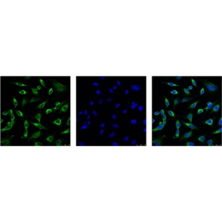 Peroxiredoxin 1 Mouse Monoclonal Antibody from Signalway Antibody (38055) - Antibodies.com