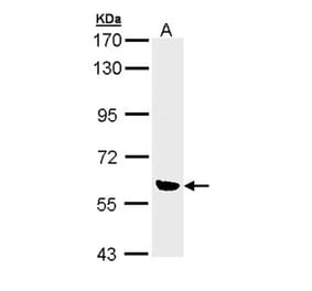 OXSR1 (OSR1) antibody from Signalway Antibody (22738) - Antibodies.com