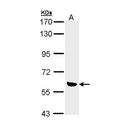 OXSR1 (OSR1) antibody from Signalway Antibody (22738) - Antibodies.com