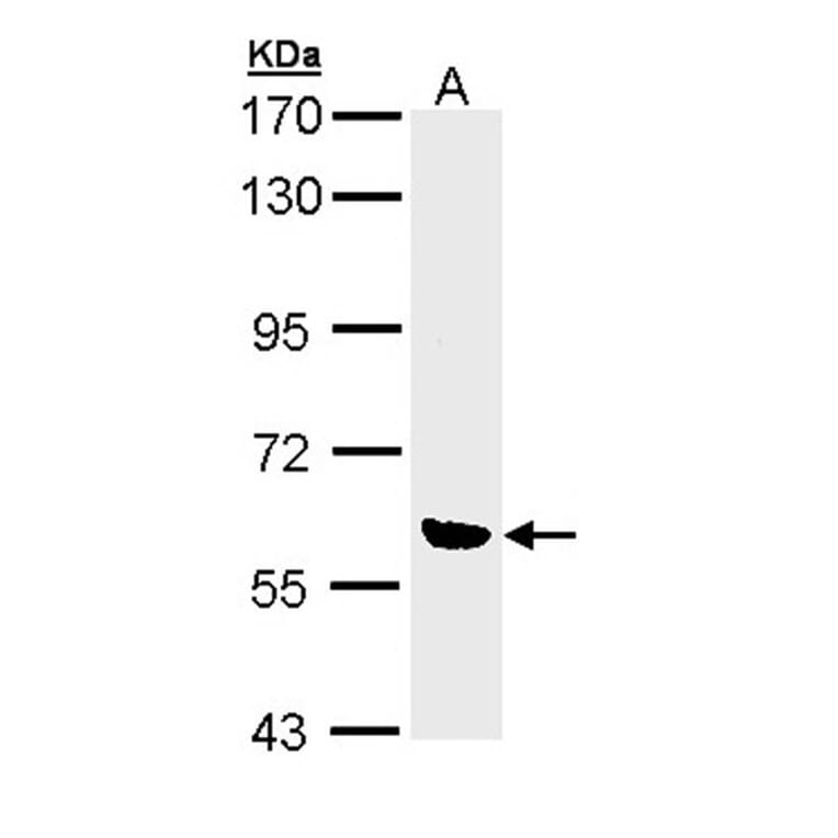 OXSR1 (OSR1) antibody from Signalway Antibody (22738) - Antibodies.com