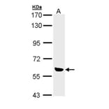 OXSR1 (OSR1) antibody from Signalway Antibody (22738) - Antibodies.com