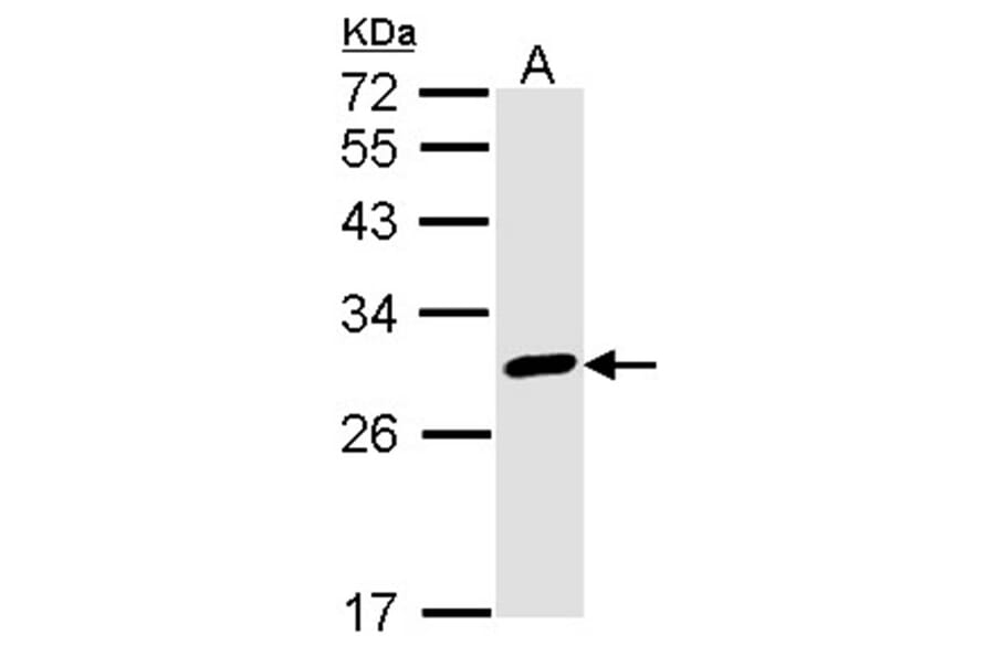Calretinin antibody from Signalway Antibody (22840) - Antibodies.com