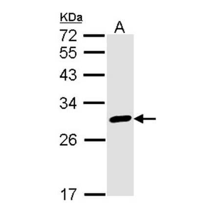 Calretinin antibody from Signalway Antibody (22840) - Antibodies.com