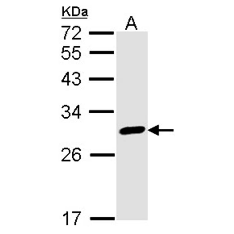 Calretinin antibody from Signalway Antibody (22840) - Antibodies.com