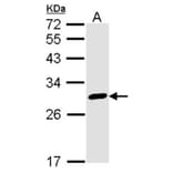 Calretinin antibody from Signalway Antibody (22840) - Antibodies.com