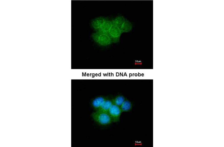 Immunofluorescence - Calretinin antibody from Signalway Antibody (22840) - Antibodies.com