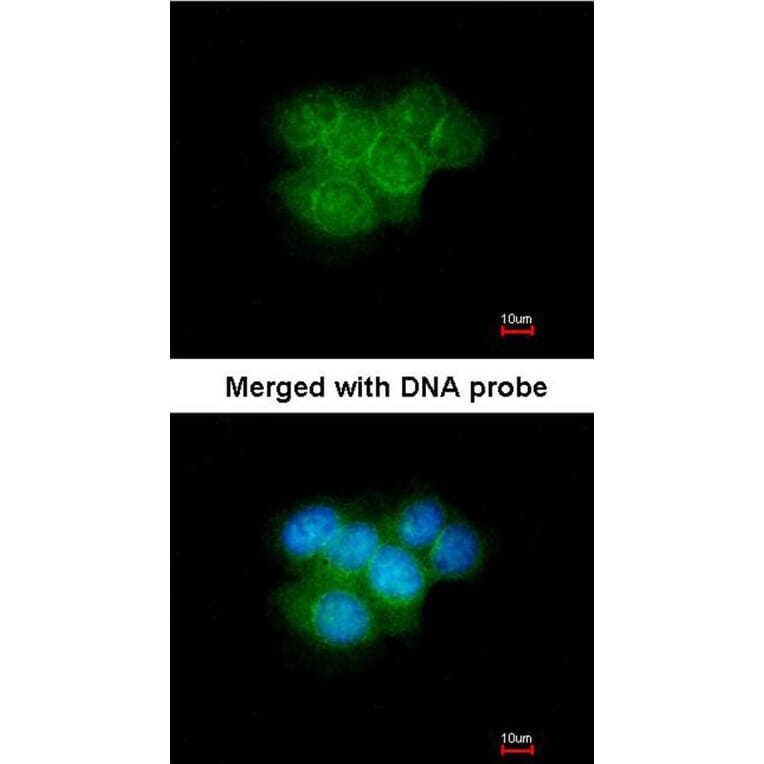 Immunofluorescence - Calretinin antibody from Signalway Antibody (22840) - Antibodies.com