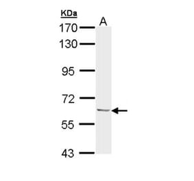 Ubiquilin-1 antibody from Signalway Antibody (22885) - Antibodies.com