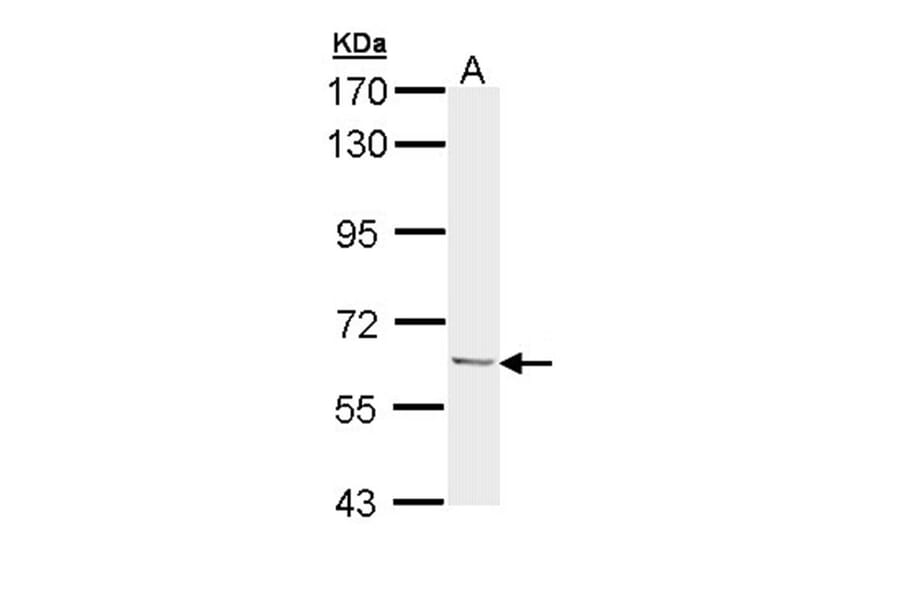 Ubiquilin-1 antibody from Signalway Antibody (22885) - Antibodies.com