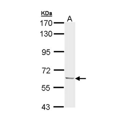 Ubiquilin-1 antibody from Signalway Antibody (22885) - Antibodies.com