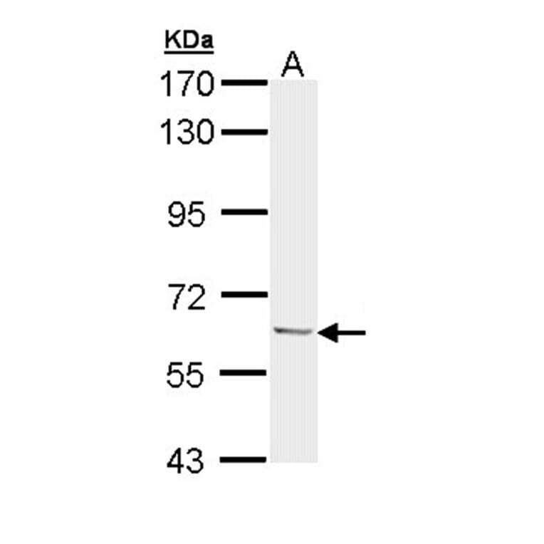 Ubiquilin-1 antibody from Signalway Antibody (22885) - Antibodies.com