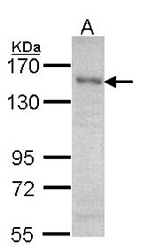 Anti-HET / SAF B Anticuerpo (A39370) | Antibodies.com