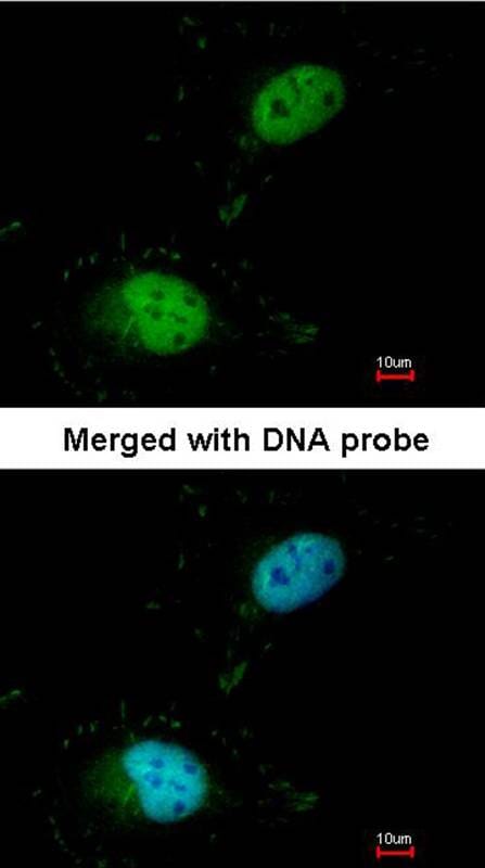 Anti-HET / SAF B Anticuerpo (A39370) | Antibodies.com