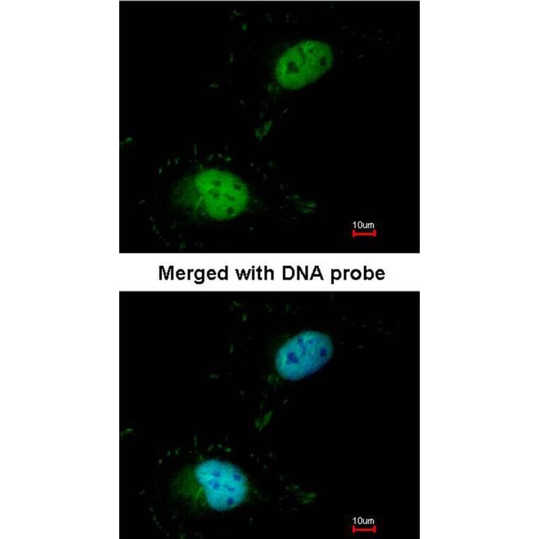 Immunofluorescence - HET/ SAF B antibody from Signalway Antibody (22927) - Antibodies.com
