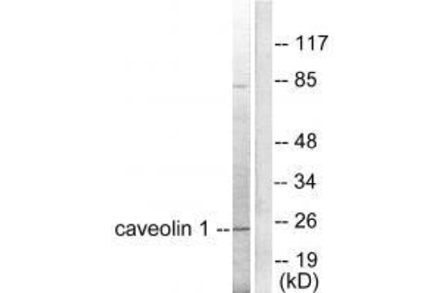 Western blot - Caveolin-1 Antibody from Signalway Antibody (33331) - Antibodies.com
