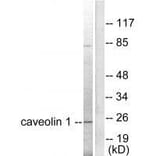 Western blot - Caveolin-1 Antibody from Signalway Antibody (33331) - Antibodies.com