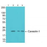Western blot - Caveolin-1 Antibody from Signalway Antibody (33331) - Antibodies.com