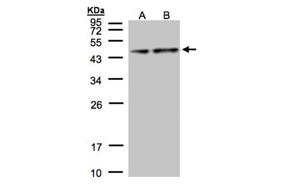 Pyruvate Dehydrogenase E1 alpha antibody from Signalway Antibody (22804) - Antibodies.com