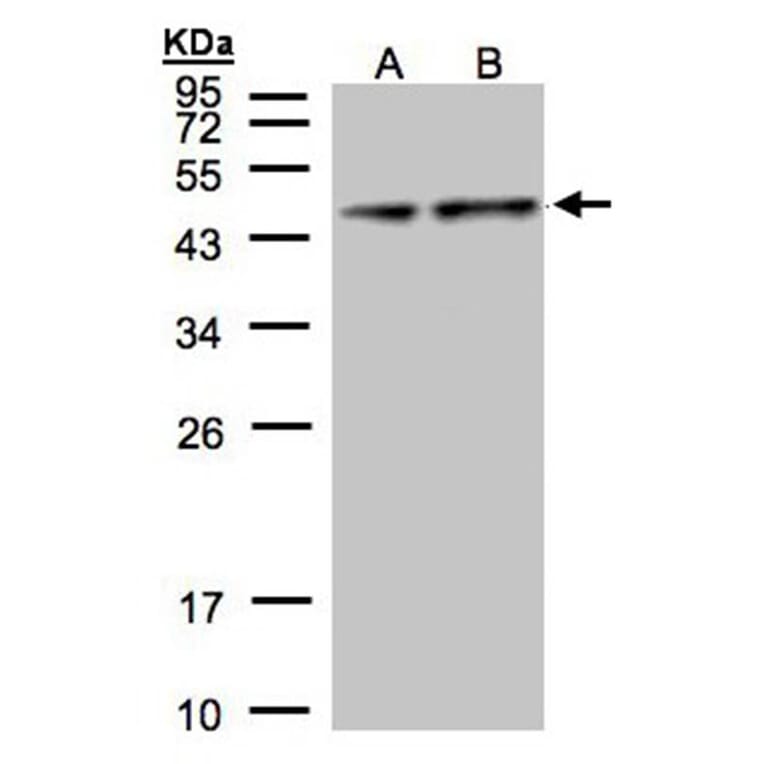 Pyruvate Dehydrogenase E1 alpha antibody from Signalway Antibody (22804) - Antibodies.com