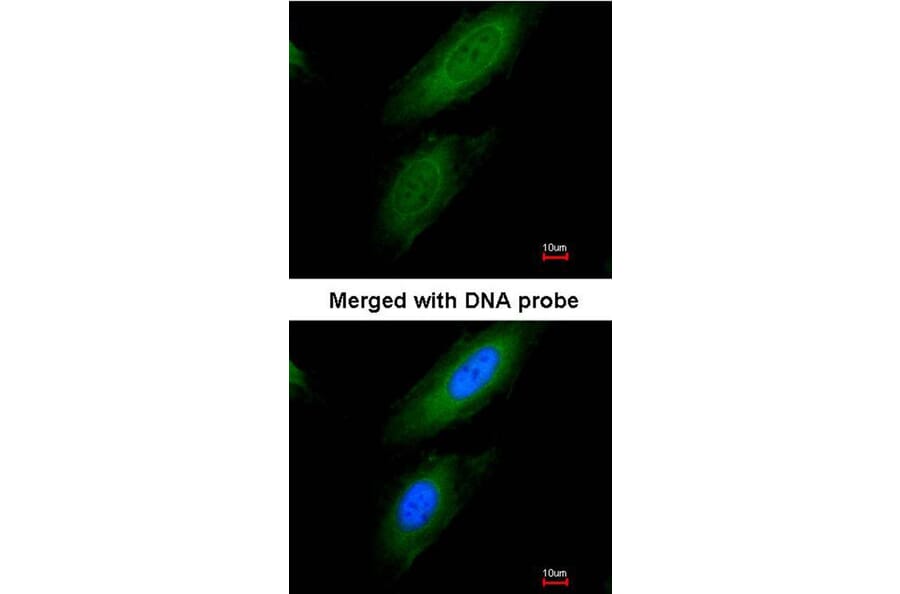 Immunofluorescence - Pyruvate Dehydrogenase E1 alpha antibody from Signalway Antibody (22804) - Antibodies.com