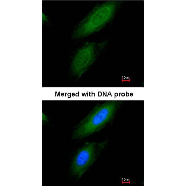 Immunofluorescence - Pyruvate Dehydrogenase E1 alpha antibody from Signalway Antibody (22804) - Antibodies.com