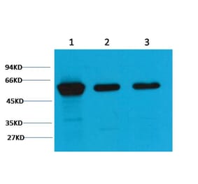 Western blot - Vimentin Mouse Monoclonal Antibody (1A7) from Signalway Antibody (38097) - Antibodies.com