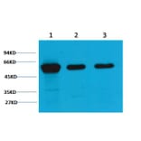 Western blot - Vimentin Mouse Monoclonal Antibody (1A7) from Signalway Antibody (38097) - Antibodies.com