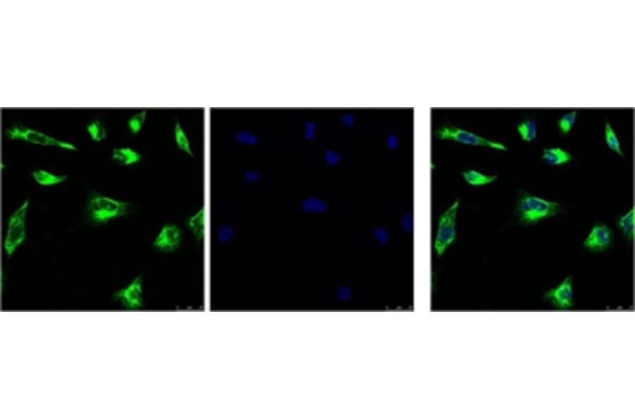 Vimentin Mouse Monoclonal Antibody (1A7) from Signalway Antibody (38097) - Antibodies.com